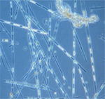 Pseudonitschia